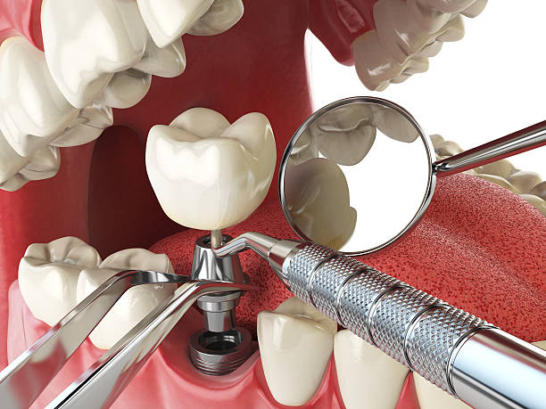 Best Mobile Emergency Dentist in Grapevine, TX